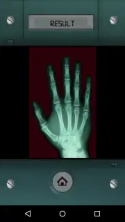 Scanner X-ray captura 5