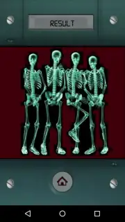 Scanner X-ray captura 1