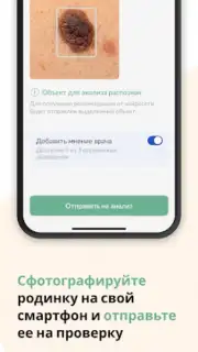 Про родинки captura 6