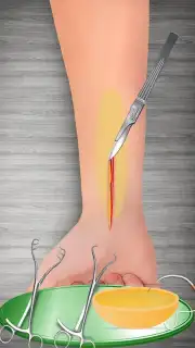 WristSurgeryDoctor captura 16