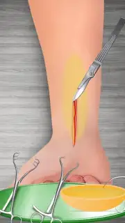 WristSurgeryDoctor captura 3