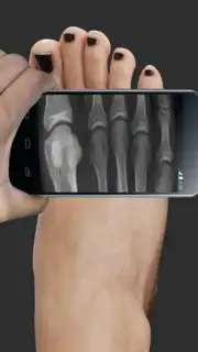 X Ray Scanner Pro captura 1